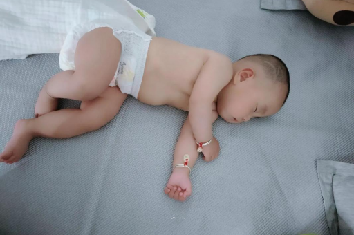 临朐六个月宝宝眼睛散光